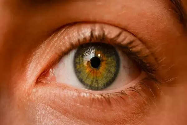 The attack of myopia on the eyes of children is increasing, so many patients found in the investigation of 200 in Dhanbad