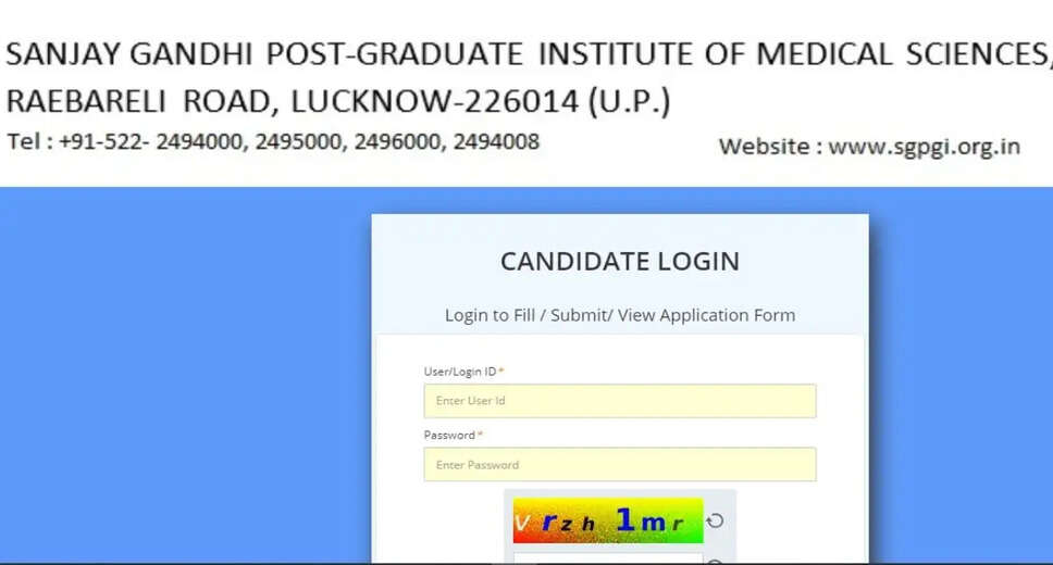 SGPGIMS Recruitment 2023: Admit Card Released, Download Now 